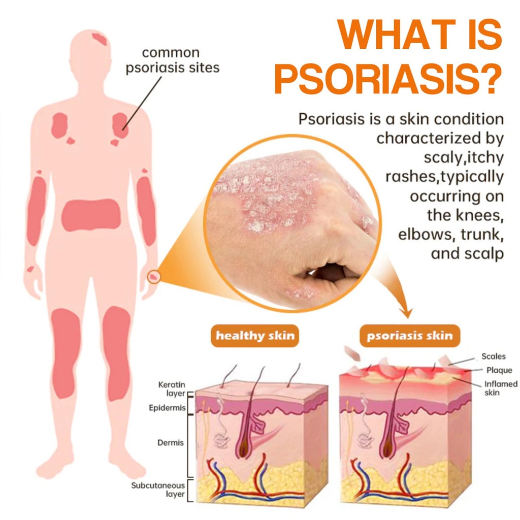 lovilds-psoriaheal-bee-venom-psoriasis-c-3.jpg