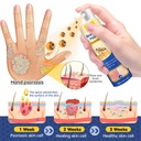 lovilds-psoriaheal-bee-venom-psoriasis-c-5.jpg