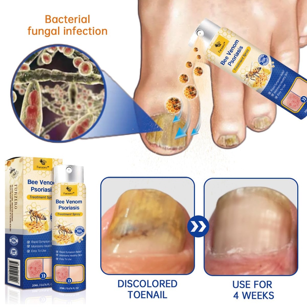 lovilds-psoriaheal-bee-venom-psoriasis-c-6.jpg