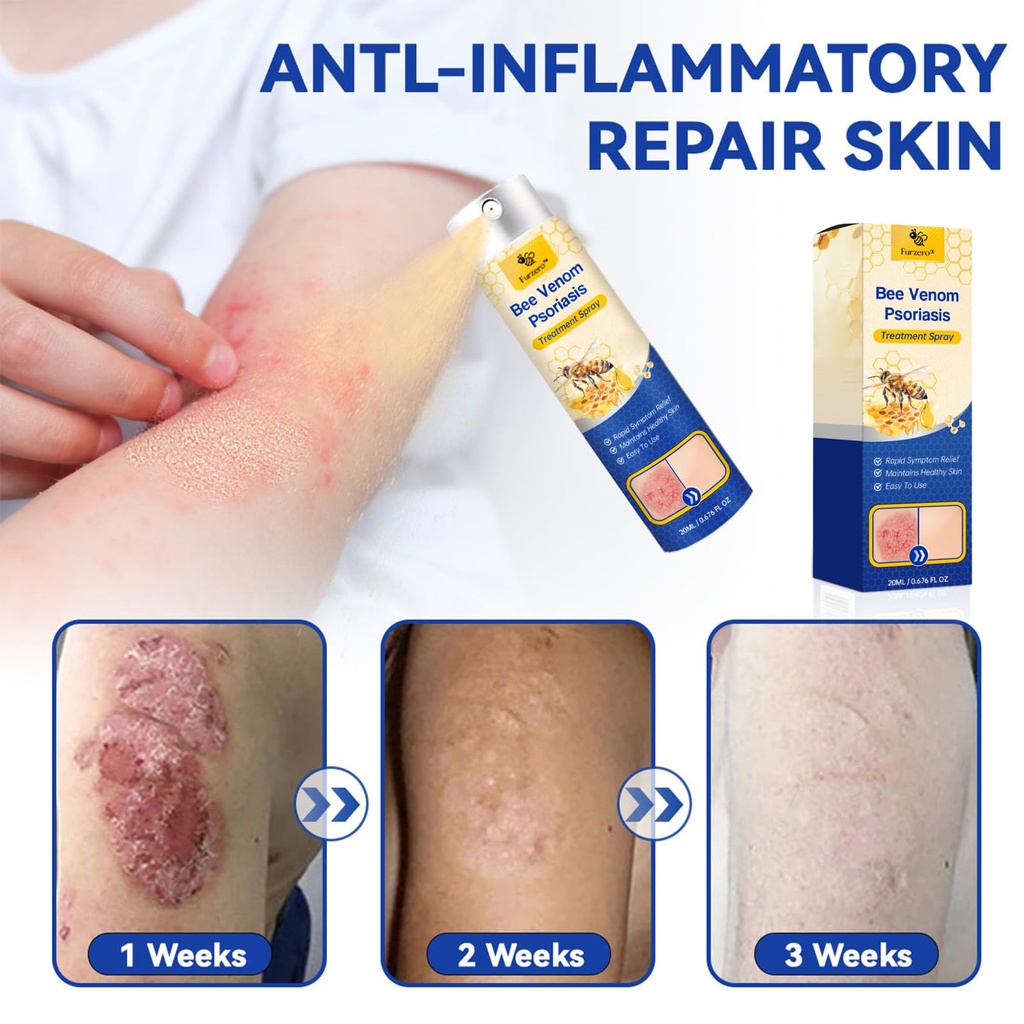 lovilds-psoriaheal-bee-venom-psoriasis-c-2.jpg