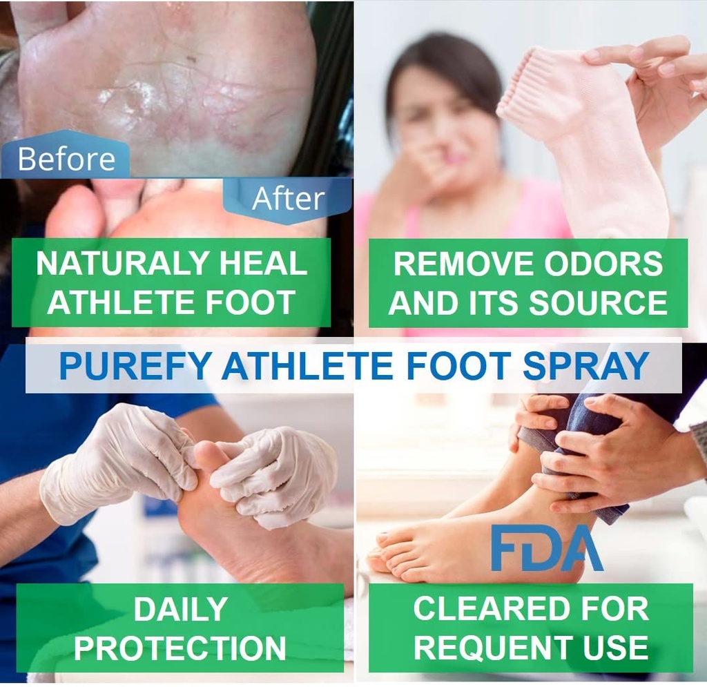 purefy-athlete-foot-spray-for-skin-4oz-2-4.jpg
