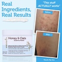eczema-cream-with-manuka-honey-colloidal-5.jpg