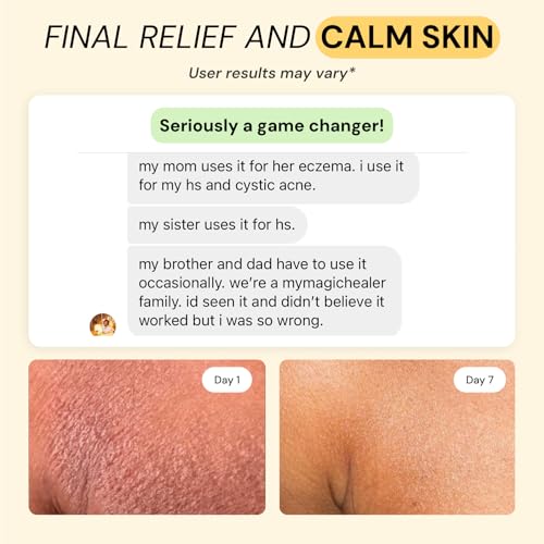 mymagichealer-complete-flare-care-trio-u-5.jpg