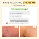 mymagichealer-complete-flare-care-trio-u-5.jpg