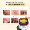 mymagichealer-complete-flare-care-trio-u-2.jpg