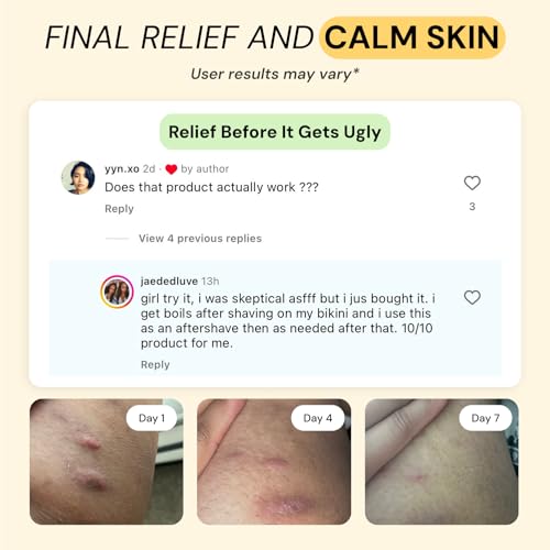 mymagichealer-complete-flare-care-trio-u-3.jpg