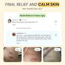 mymagichealer-complete-flare-care-trio-u-3.jpg