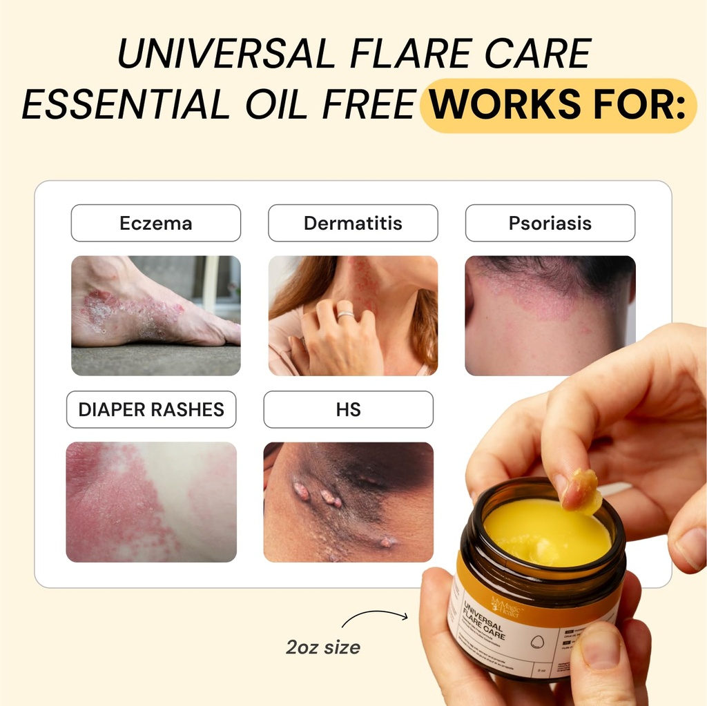 mymagichealer-complete-flare-care-trio-u-4.jpg