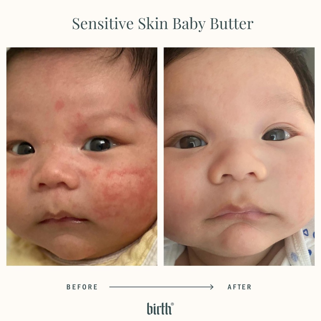 birth-s-baby-eczema-butter-steroid-free--3.jpg