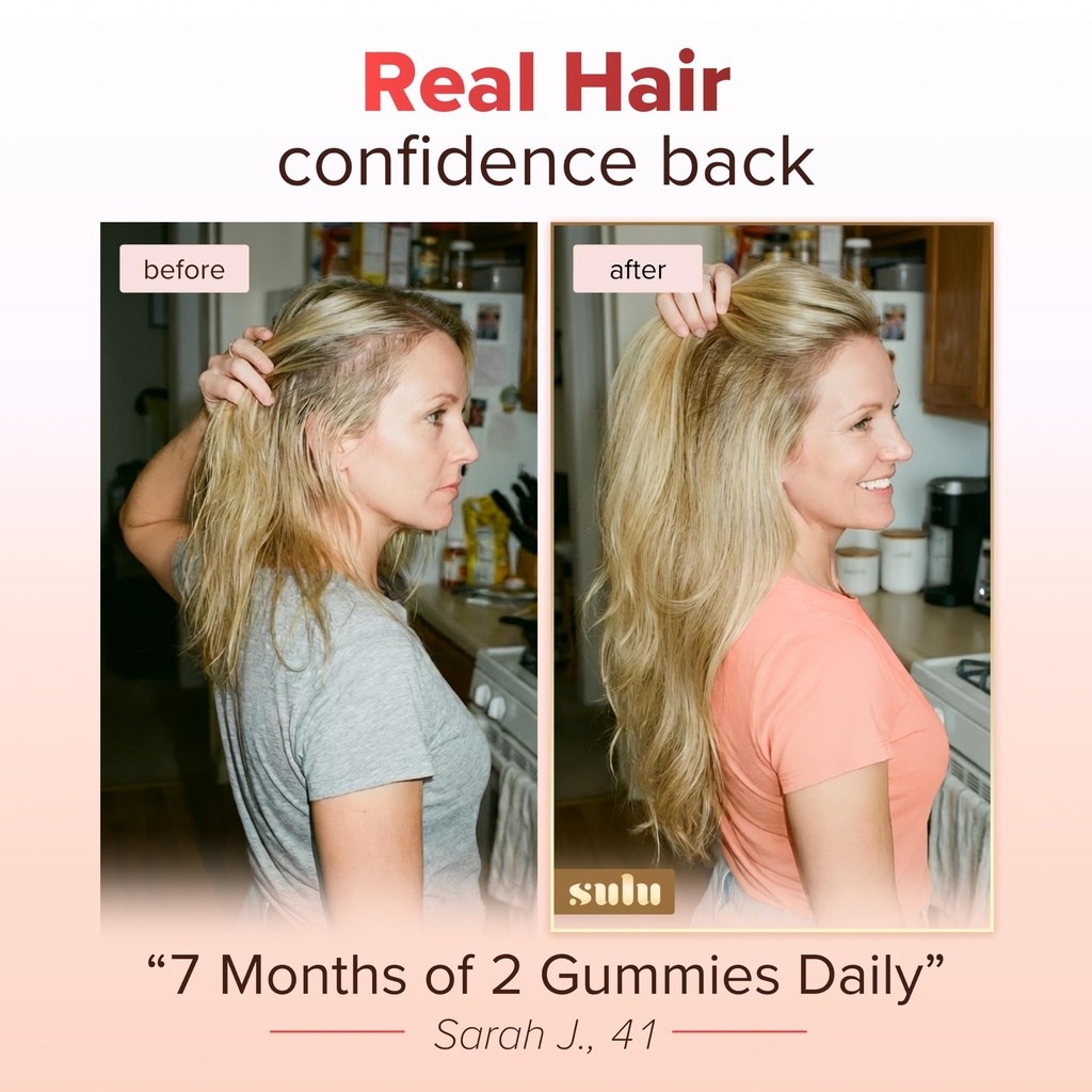 sulu-hair-growth-gummies-biotin-suppleme-4.jpg