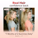 sulu-hair-growth-gummies-biotin-suppleme-4.jpg