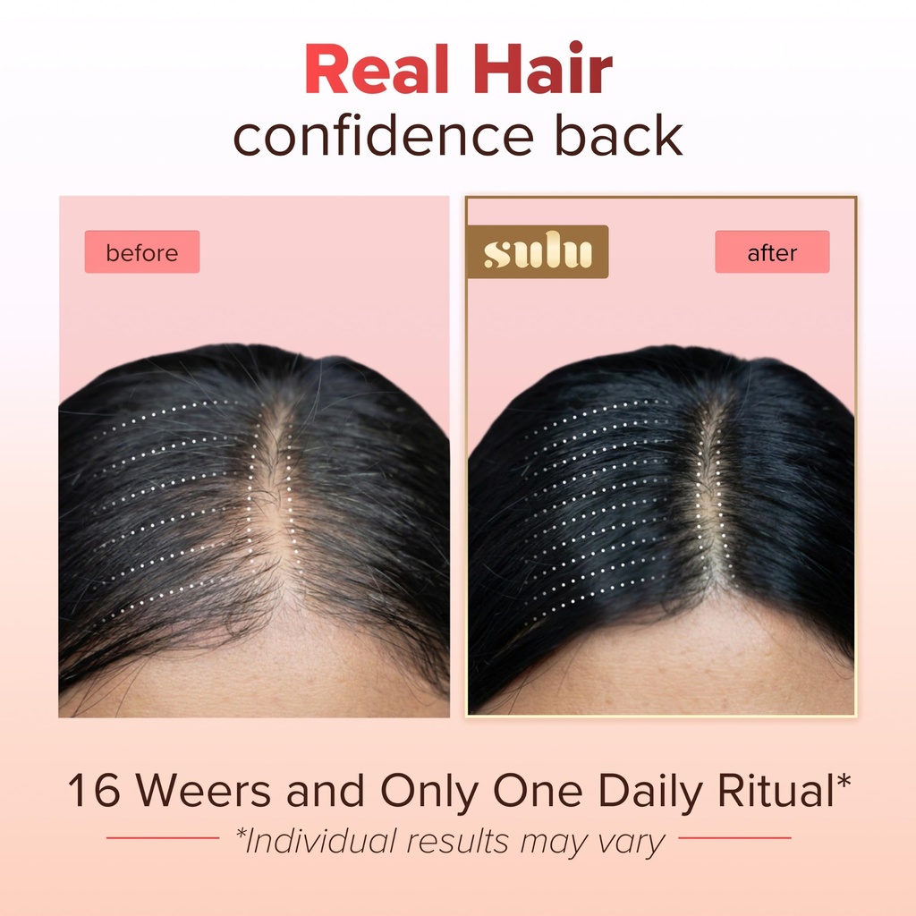 sulu-hair-growth-gummies-biotin-suppleme-2.jpg