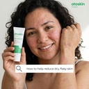 atoskin-eczema-cream-psoriasis-folliculi-5.jpg