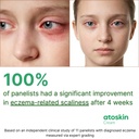 atoskin-eczema-cream-psoriasis-folliculi-6.jpg