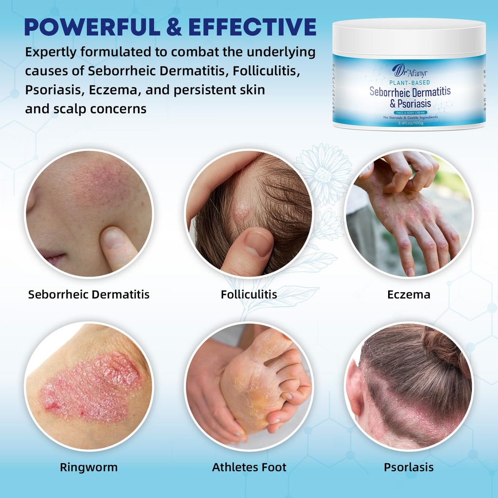 seborrheic-dermatitis-psoriasis-care-cre-2.jpg