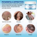 seborrheic-dermatitis-psoriasis-care-cre-2.jpg