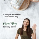 salve-cosalic-coal-tar-salicylic-acid-oi-6.jpg