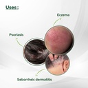 salve-cosalic-coal-tar-salicylic-acid-oi-4.jpg