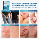 roycederm-herpes-cream-soothes-itching-r-4.jpg