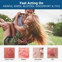 roycederm-herpes-cream-soothes-itching-r-3.jpg