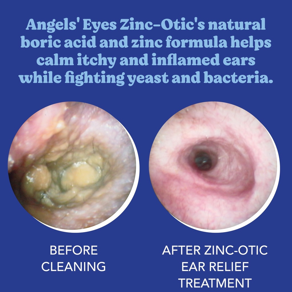 angels-eyes-zinc-otic-ear-relief-treatme-3.jpg