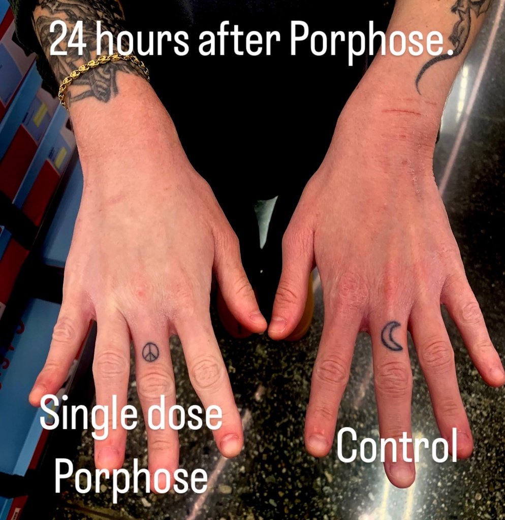porphose-eczema-relief-spray-for-kids-an-2.jpg