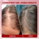 hair-growth-vitamins-gummies-for-black-w-6.jpg