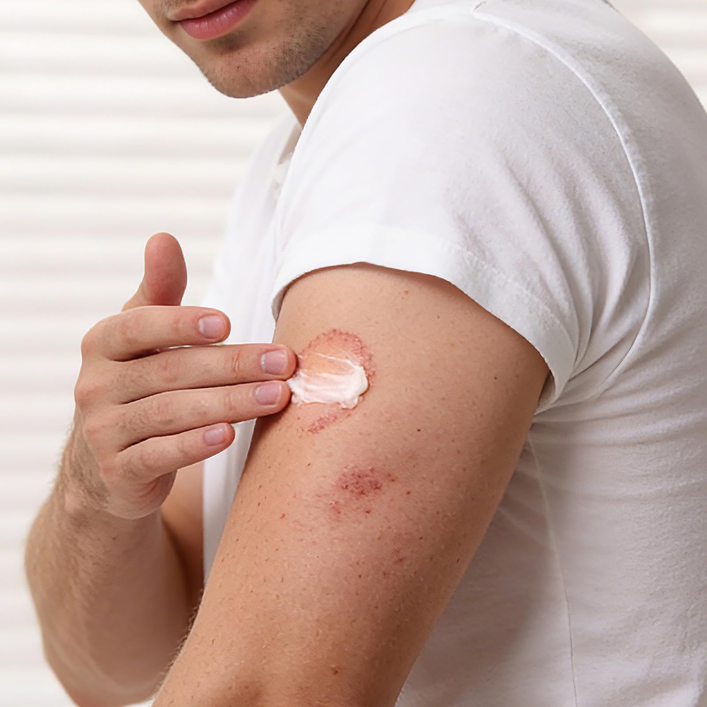 antifungal-cream-for-jock-itch-athletes--6.jpg