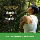 a-d-medicated-rash-ointment-1-5-oz-relie-3.jpg