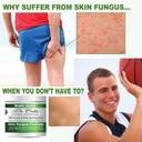 dr-cole-s-organic-herbal-skin-fungus-soa-3.jpg