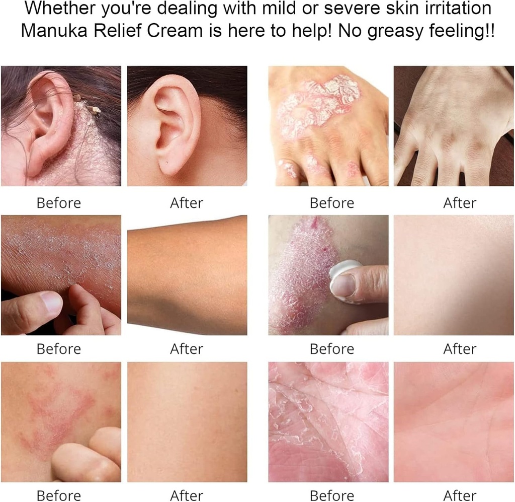 tea-tree-oil-balm-heat-rash-cream-jock-i-6.jpg
