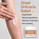 urticaria-cream-for-hives-relief-fast-ac-6.jpg