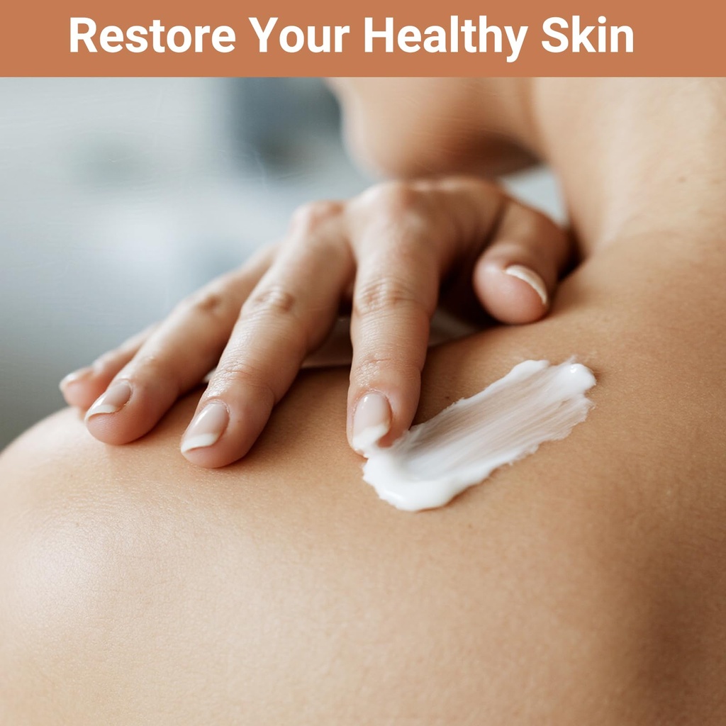 urticaria-cream-for-hives-relief-fast-ac-3.jpg