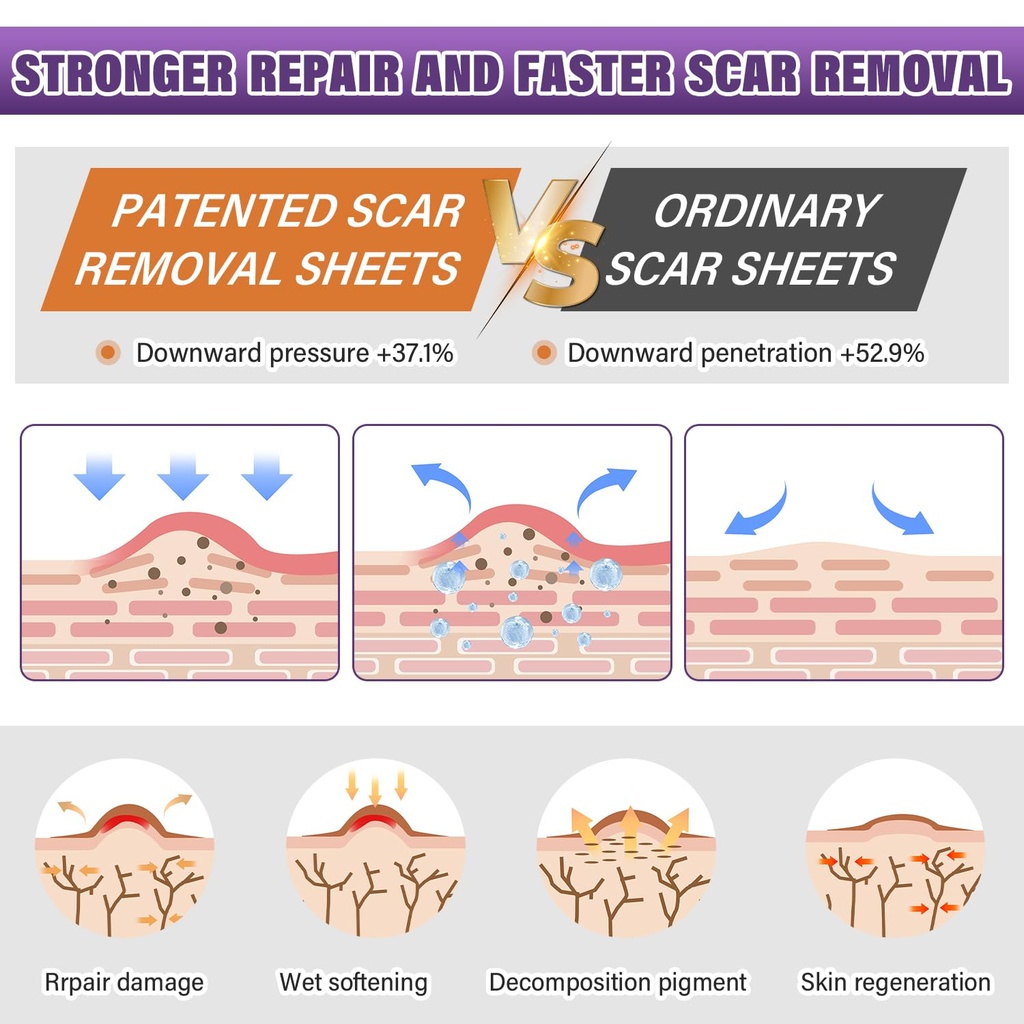silicone-scar-sheets-medical-grade-silic-3.jpg