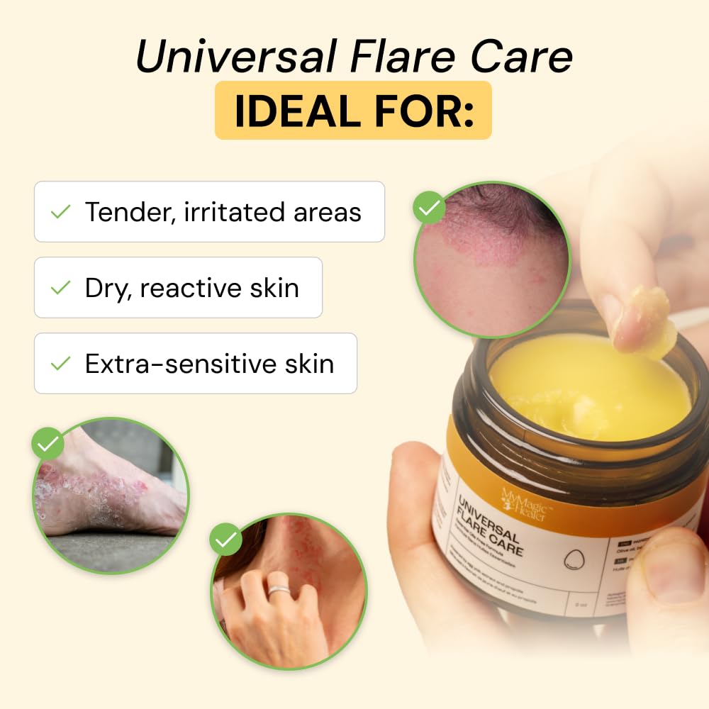 mymagichealer-universal-flare-care-essen-2.jpg