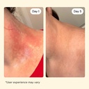 mymagichealer-universal-flare-care-essen-3.jpg