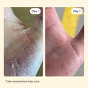 mymagichealer-universal-flare-care-essen-5.jpg