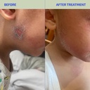 codex-labs-kids-skin-barrier-support-gum-4.jpg
