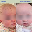 codex-labs-infant-toddler-skin-barrier-s-6.jpg