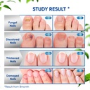 maximum-strength-toenail-fungus-treatmen-4.jpg