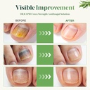toenail-fungus-treatment-extra-strength--3.jpg
