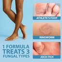 curist-terbinafine-cream-antifungal-1oz--4.jpg