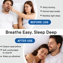 anti-snoring-devices-snoring-solution-wi-3.jpg