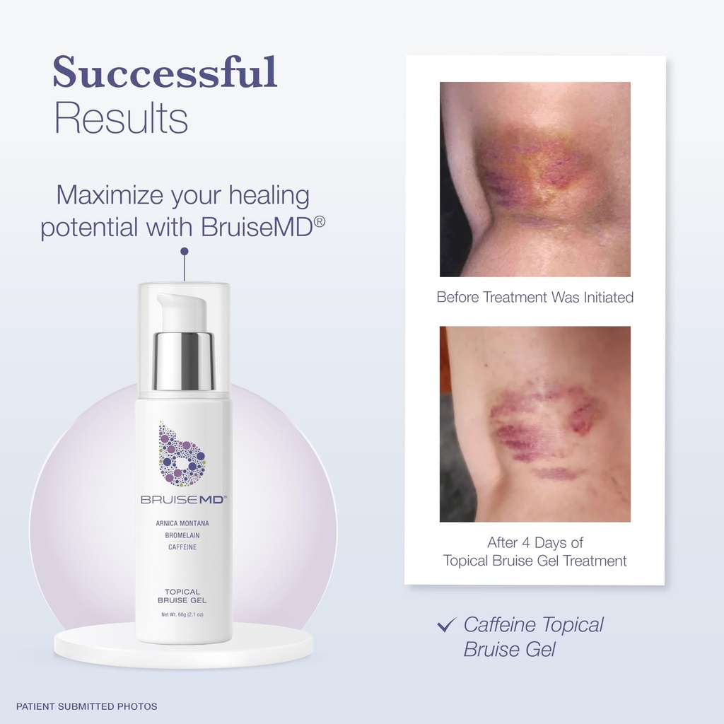 topical-gel-for-bruising-and-swelling-20-4.jpg