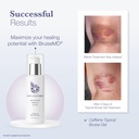 topical-gel-for-bruising-and-swelling-20-4.jpg