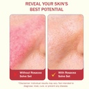 healfast-rosacea-set-includes-rosacea-cr-5.jpg
