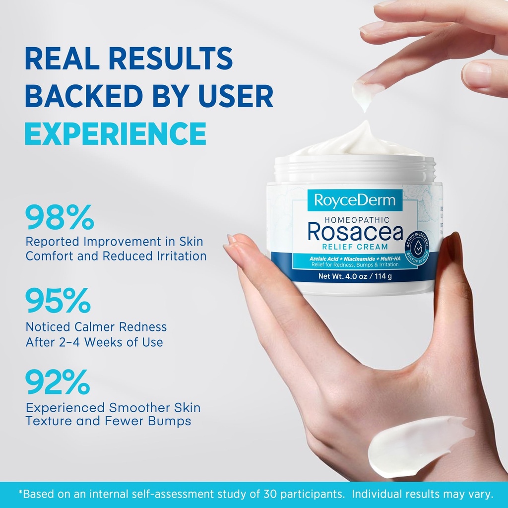 roycederm-face-cream-for-rosacea-prone-s-5.jpg