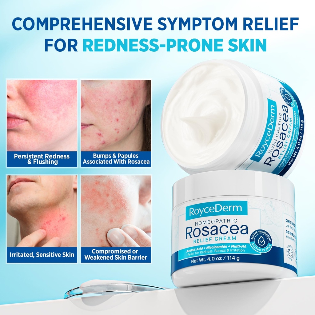 roycederm-face-cream-for-rosacea-prone-s-2.jpg