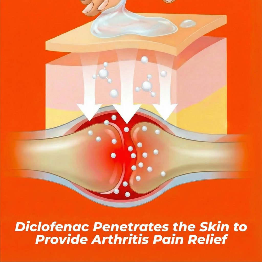 aspercreme-arthritis-pain-relief-gel-for-6.jpg