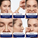 massner-nose-strips-for-breathing-large--2.jpg